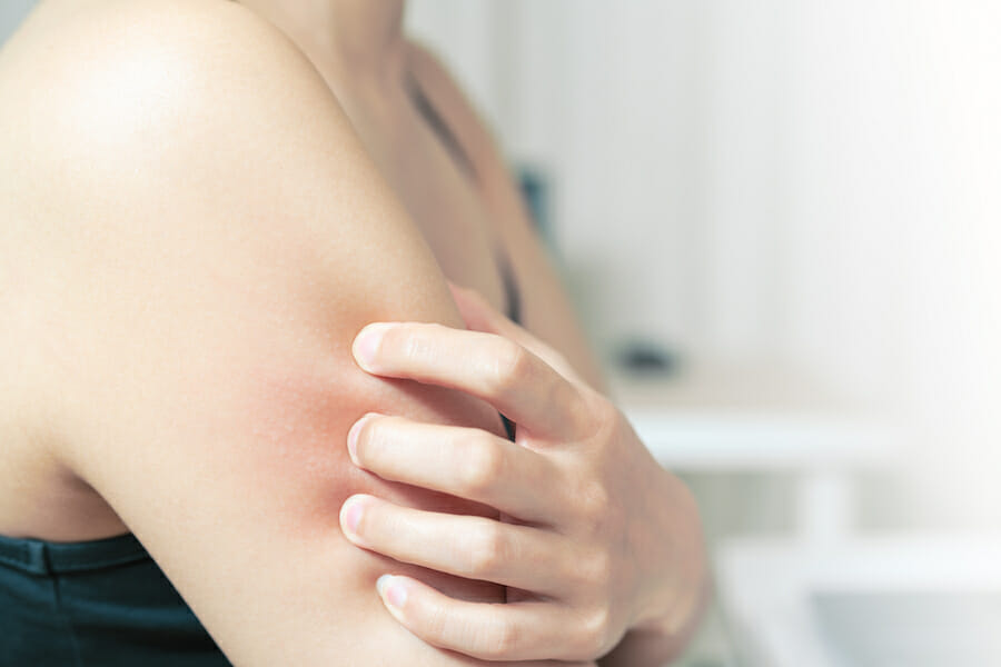 hard water and irritated skin