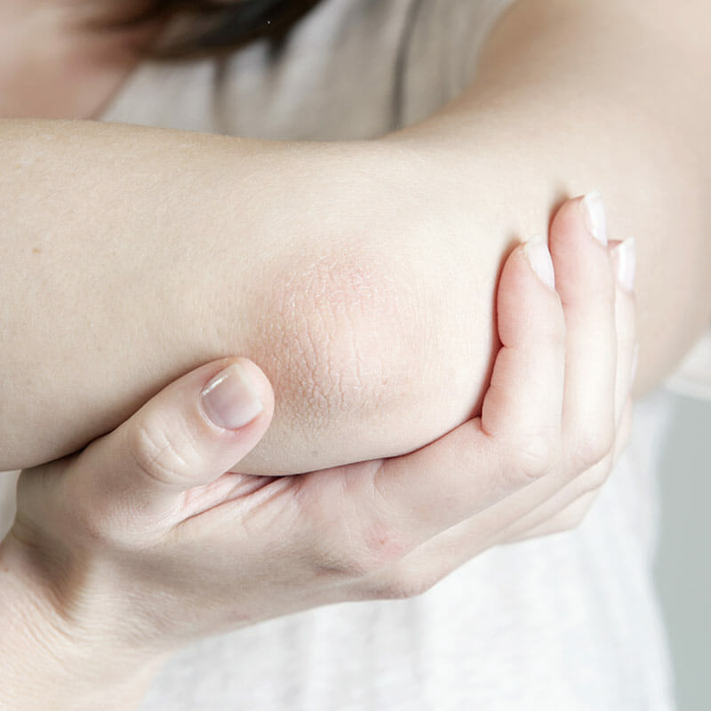 Close-up of dry elbow skin affected by hard water minerals
