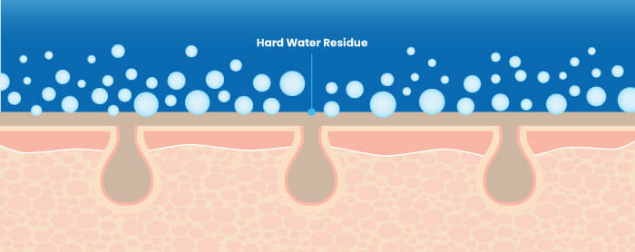 hard water and skin soap